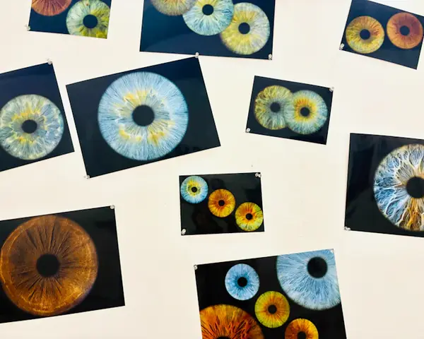 Fotografías de iris de distintos colores